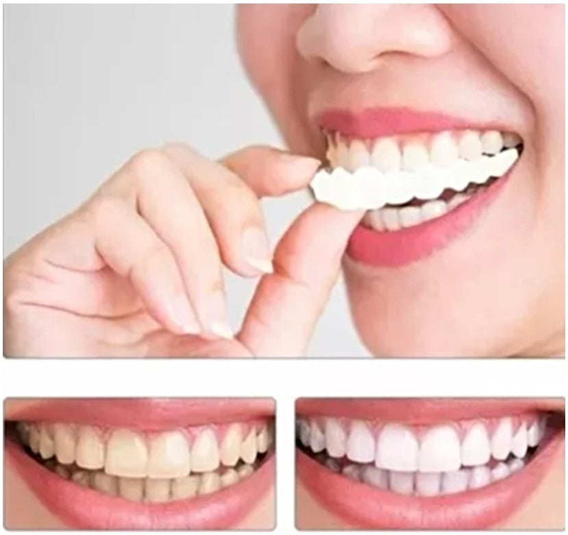 Carillas Dentales Pack x 50