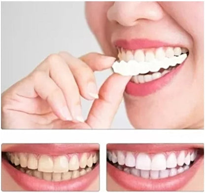 Carillas Dentales Pack x 50