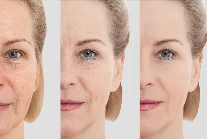 MASAJEADOR FACIAL INALAMBRICO RECARGABLE