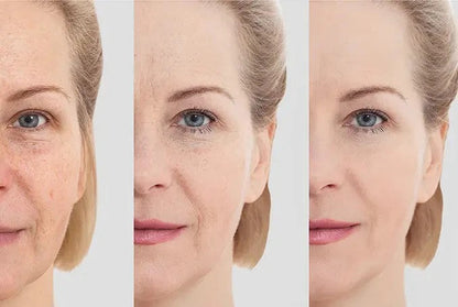 MASAJEADOR FACIAL INALAMBRICO RECARGABLE