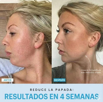 MASAJEADOR FACIAL INALAMBRICO RECARGABLE