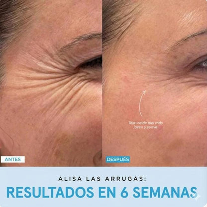 MASAJEADOR FACIAL INALAMBRICO RECARGABLE