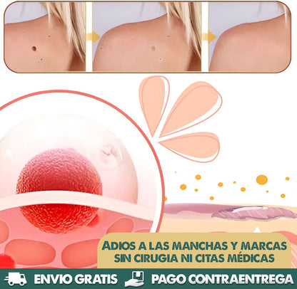 ¡Elimina Verrugas Rápido y Sin Dolor! | Lápiz Removedor Profesional